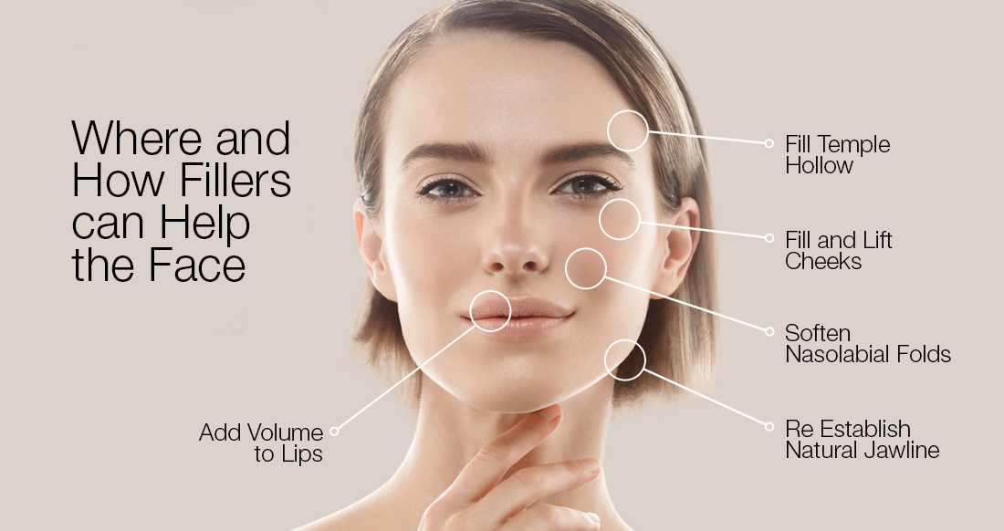 ira_dermal_fillers_kusadasi_1